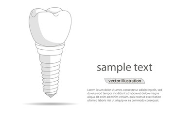 dental implant logo, icon. Implantation dentistry and care to teeth. illustration