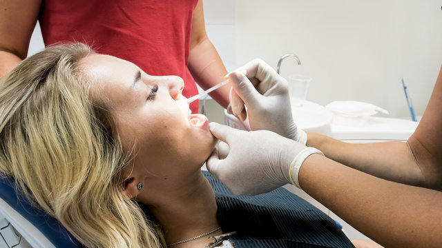Closeup image of dentist removing lipstick from patients lips with cotton swab