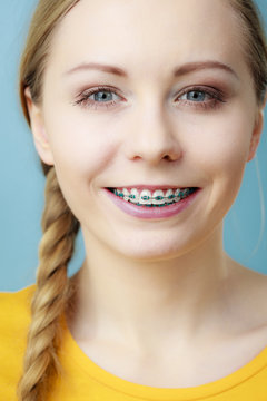 Young woman showing teeth braces