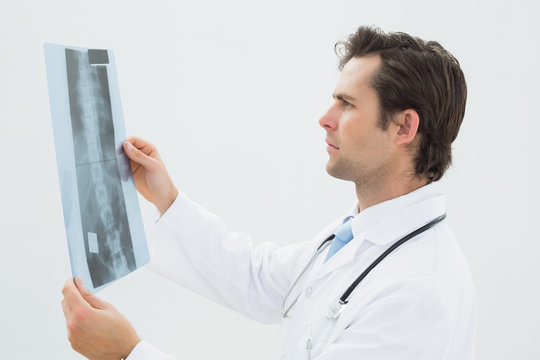 Concentrated Male Doctor Examining Spine Xray