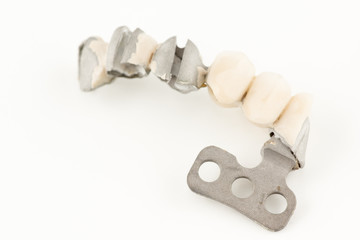 damaged dental prosthesis