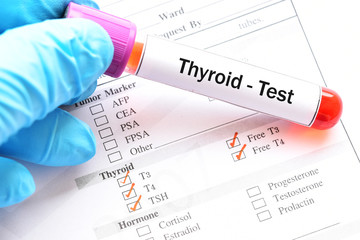 Obraz premium Blood sample for thyroid hormone test