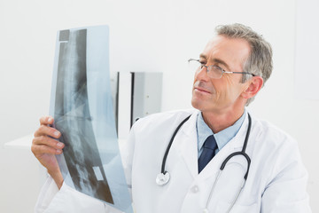 Doctor looking at xray picture of spine in office