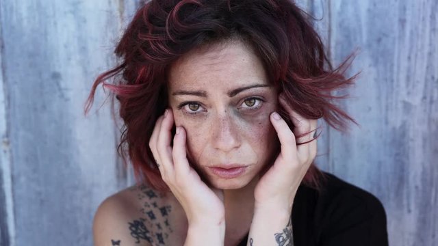 A woman With Wounds On Her Face looking the camera. Victim,violence