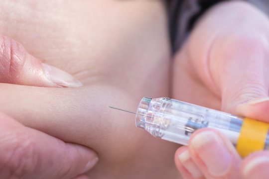 Medikament wird zur Thromboseprophylaxe in das Fettgewebe gespritzt