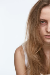 Fototapeta premium Exhausted Young Woman With Bruises Under Eyes
