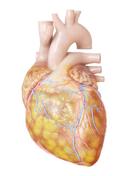 3d Rendered, Medically Accurate Illustration Of A Fatty Heart