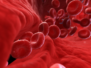 Fototapeta premium 3d rendered, medically accurate illustration of an injured artery