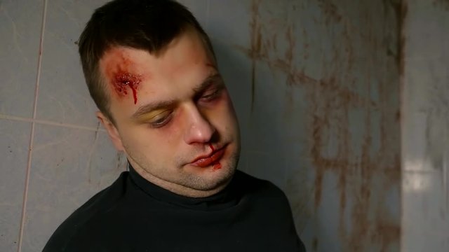 a portrait of an adult male who has a bruise on his face, he looks like a madman and lies in a dirty room