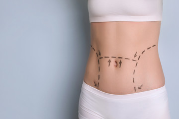 Young woman with marks on belly for cosmetic surgery operation against color background