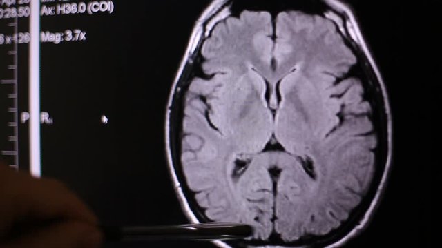 Doctor looking at computer screen while patient moving in mri machine, the doctor analyzes the results of Magnetic resonance imaging on his laptop, background blur