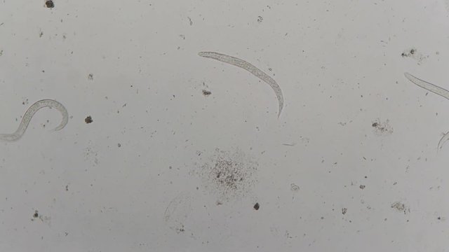parasite : Strongyloides stercoralis from human feces under microscope. testing in laborator