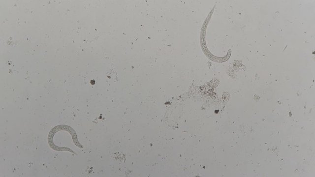 parasite : Strongyloides stercoralis from human feces under microscope. testing in laborator