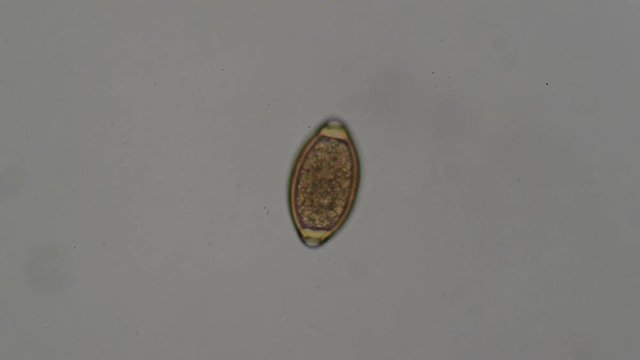 parasite : trichuris trichiura , egg stage from human feces under microscope. testing in laboratory