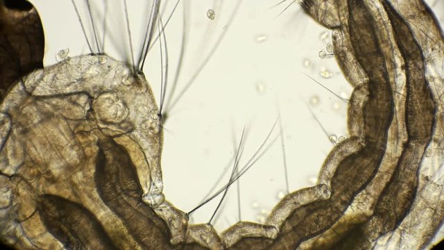larva of a mosquito under a microscope
