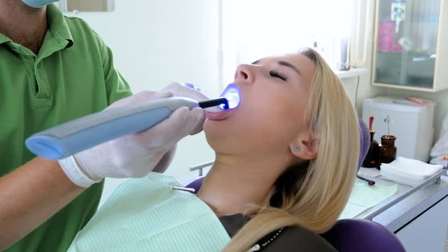 Closeup 4k footage of dentist using UV photopolymer and lamp for teeth curing