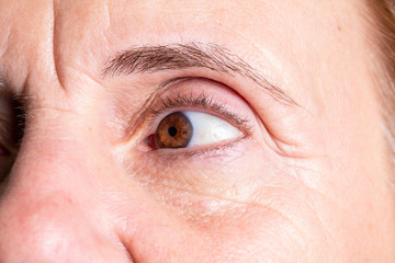 Fototapeta premium Wrinkled eye of bautiful mature woman with crow's feet reduced by botox injection