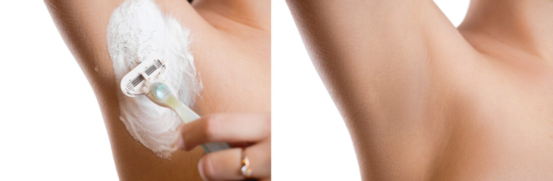 Armpit Razor Cream Closeup, Girl Shaves Her Armpit With A Razor, Before And After Shaving Depilation