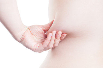 large fold of fat on the side of a woman (overweight, obesity)