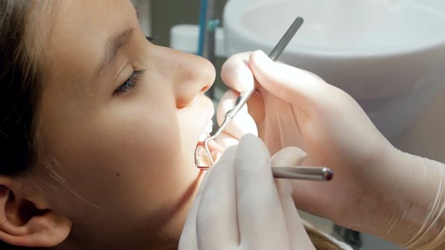 Closeup 4k footage of dentist inspecting teenager girl's teeth