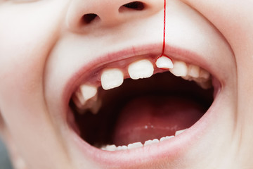 Tearing out a baby's tooth from a girl with a red string
