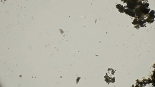 infusoria lacrimaria to hunt and quickly moves under a microscope