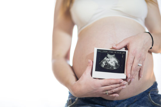 pregnant woman showing a picture of an ultrasound scan