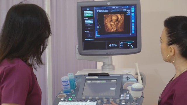 two attractive women doctors gynecologists sitting in the ward and looking at the four dimensional ultrasound scan of baby. on the screen of a 2D 3D 3D image of a child in the womb. medical symposium