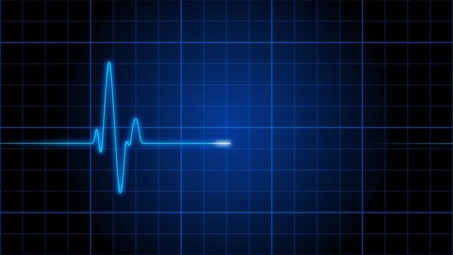 An electrocardiogram EKG heart monitor pulses on a blue grid (Loop).