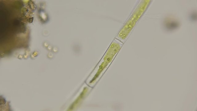 filamentous algae under a microscope