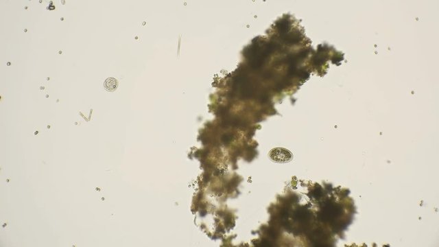 ciliated infusorians under a microscope