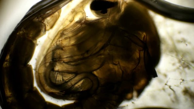 Anopheles mosquito maculipennis larva under a microscope