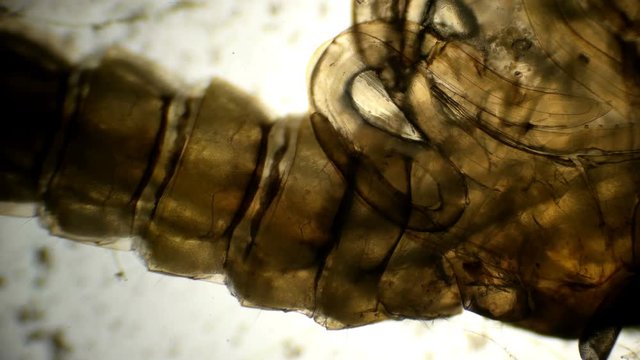 Anopheles mosquito maculipennis larva under a microscope