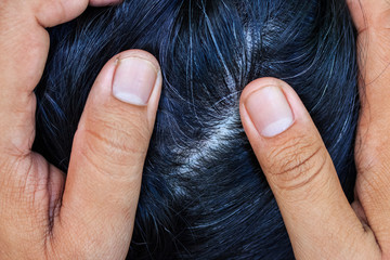 Fototapeta premium Young woman shows her gray hair roots