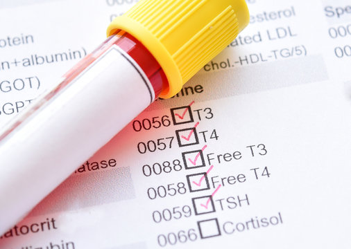 Blood sample for thyroid hormone test