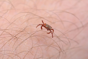 Danger of tick bite. Mite on the skin