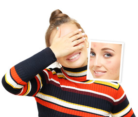 Post-Acne Marks /Treating Acne Scars.Acne Scar Removal