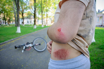 young male athlete injured his back and elbow after falling off a bicycle. Bicycle accident