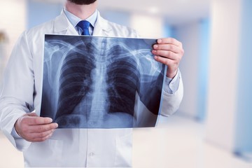 Young male doctor examining x-ray