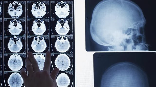 Analyzing x-rays