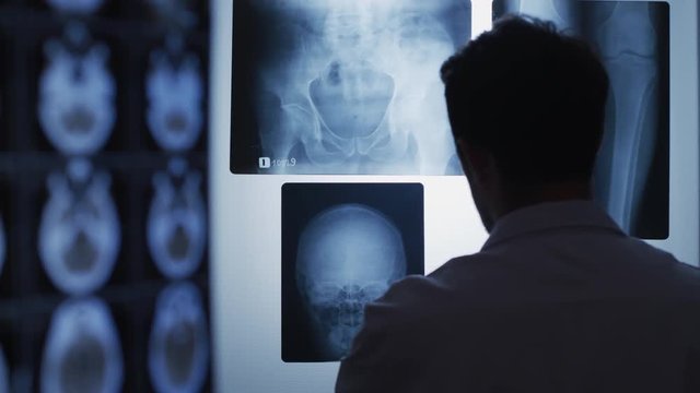 Doctor analyzing an X-ray picture of a skull