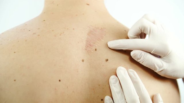 Specialists skin moles check-up 4K