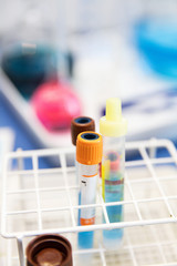 Symbolbild Blutprobe