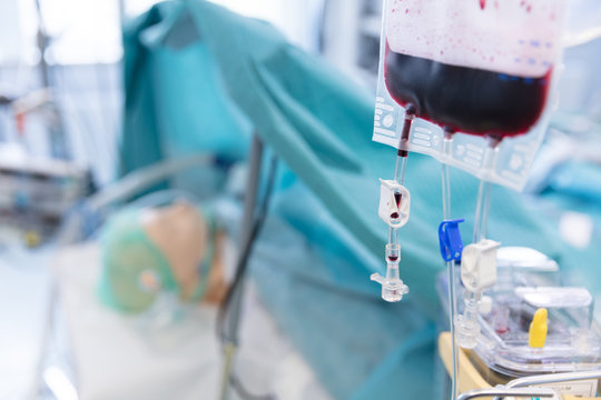 Blutkonserve w&auml;hrend einer Operation