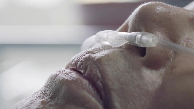 Elderly woman with nasal breathing tube to help with her breathing