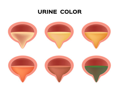 Urine Color Vector / Transparent Yellow Red Brown And Green