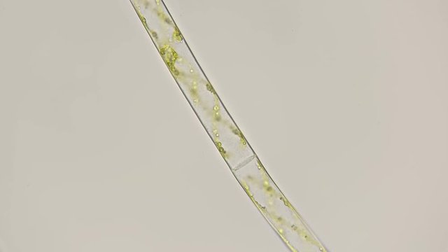 filamentous algae Spirogrya under the microscope
