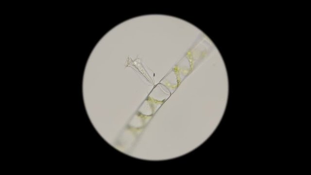 filamentous algae Spirogrya under the microscope