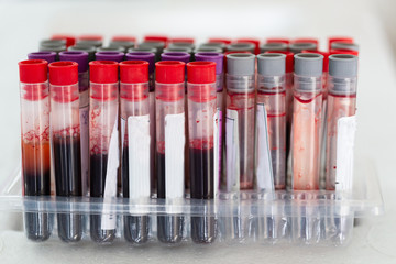 Blood collection tubes