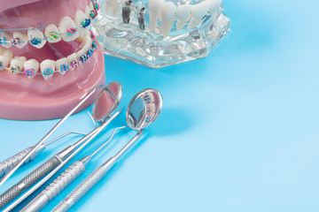 orthodontic model and dentist tool - demonstration teeth model of varities of orthodontic bracket or brace